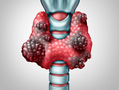 cirendo-cancer