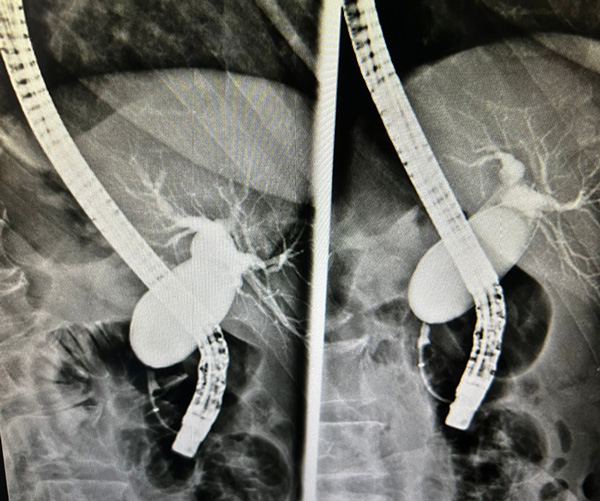 endoscopia2